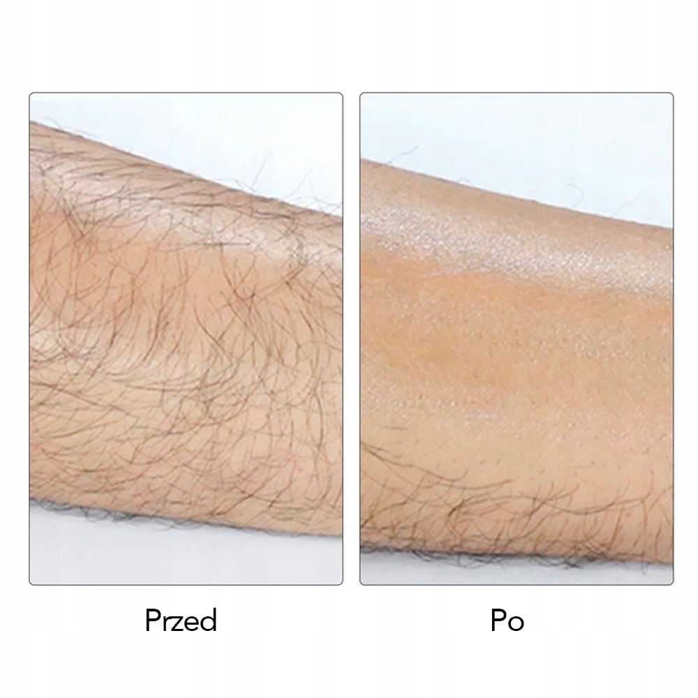 DEPILATOR KRYSZTAŁOWY EPILATOR DO DEPILACJI blue Model DEPILATOR