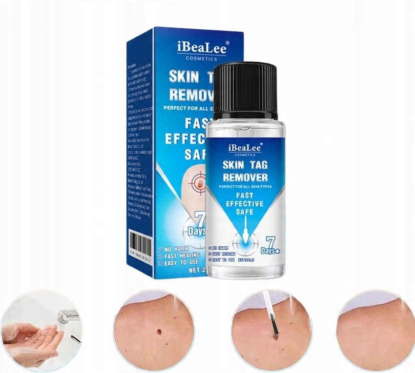 Silný přípravek na odstranění fibromů, bradavic a kuřích ok – 20 ml