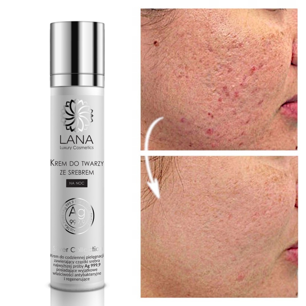 Krém na jizvy po akné a pigmentové skvrny Stříbro 50 ml