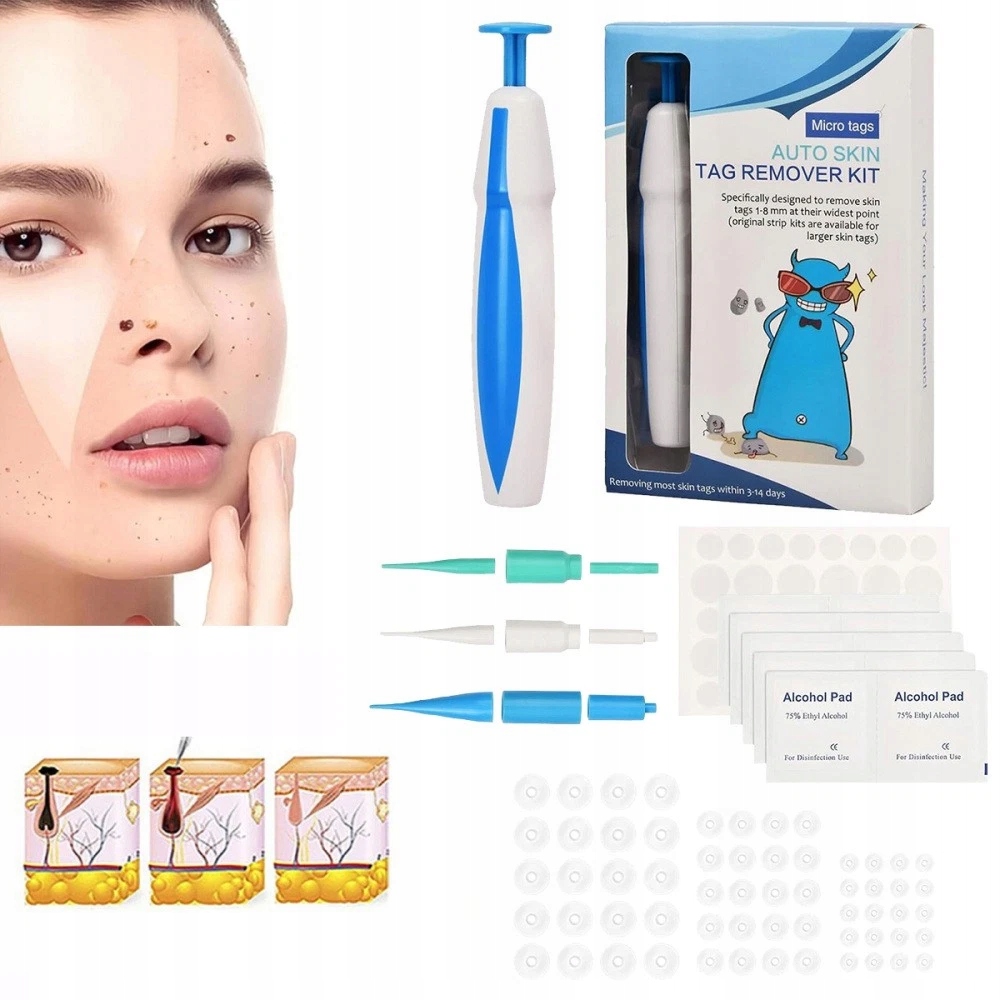 kůže, odstraňování znamének, odstraňování otisků, zařízení na odstraňování bradavic