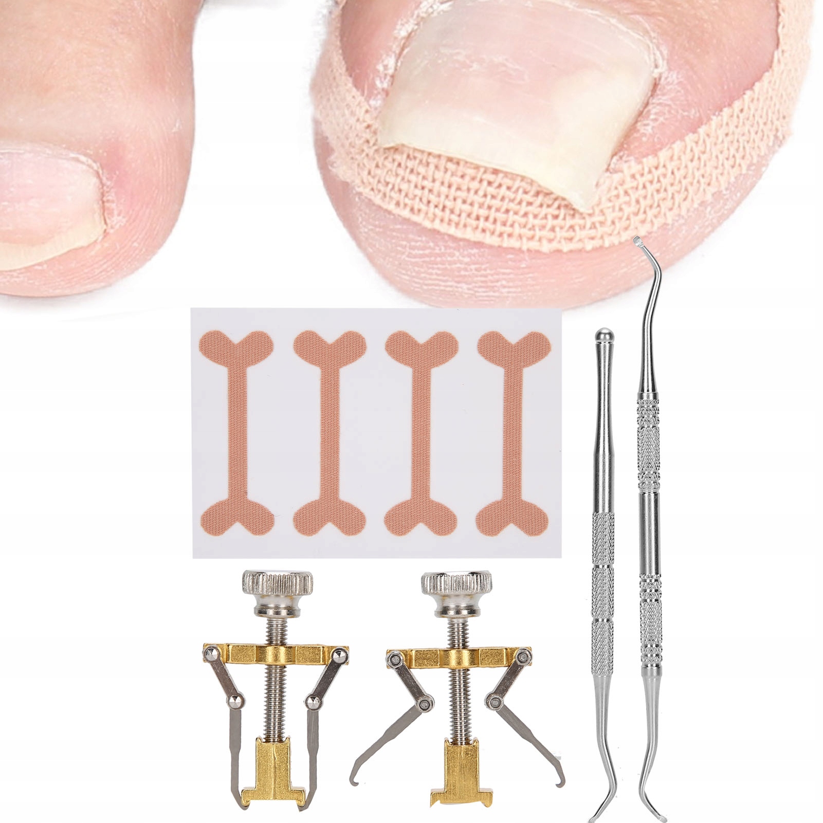 ZESTAW KOREKCYJNY NA WRASTAJĄCE PAZNOKCIE KLAMRY Stan opakowania oryginalne