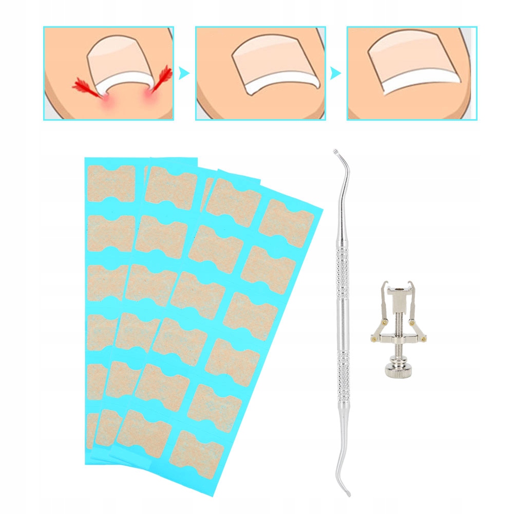 WRASTAJĄCY PAZNOKIEĆ KOREKTOR WRASTAJĄCY KOREKTOR