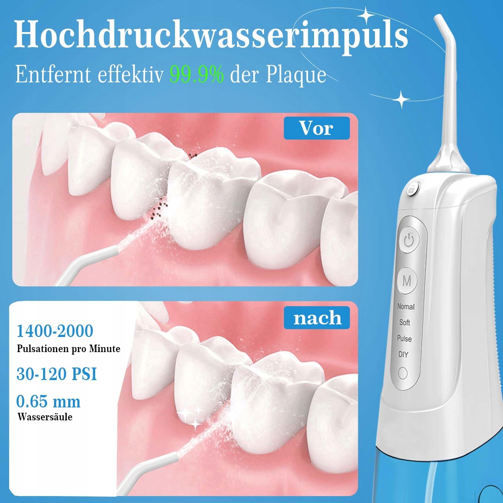 SURFOU Bezprzewodowy Irygator Do Zębów Elektryczna Nić Dentystyczna — miniatura 2