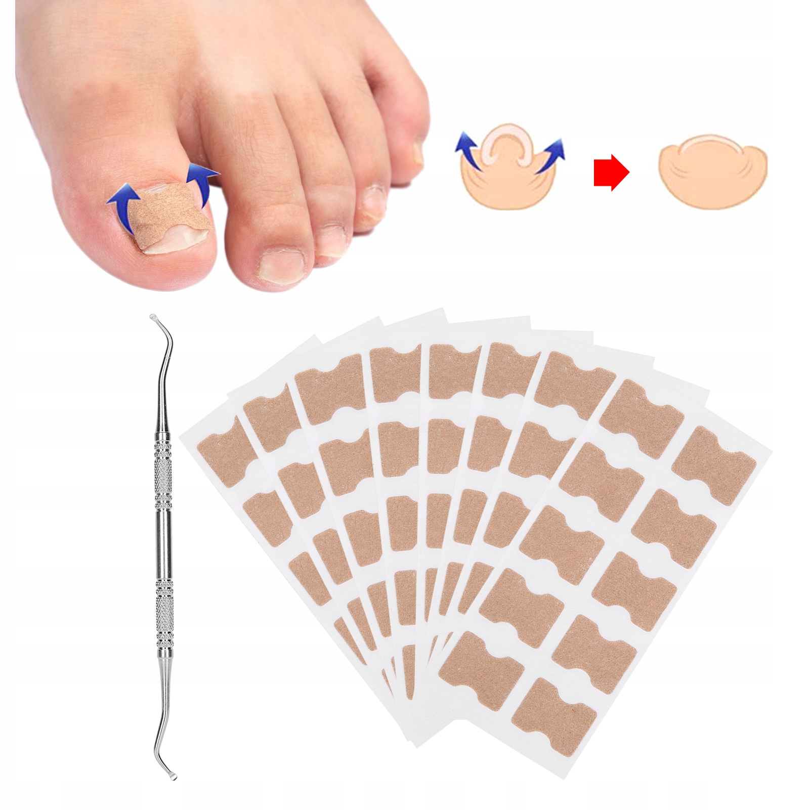 PLASTRY NA WRASTAJĄCE PAZNOKCIE U STÓP Z NARZĘDZIE