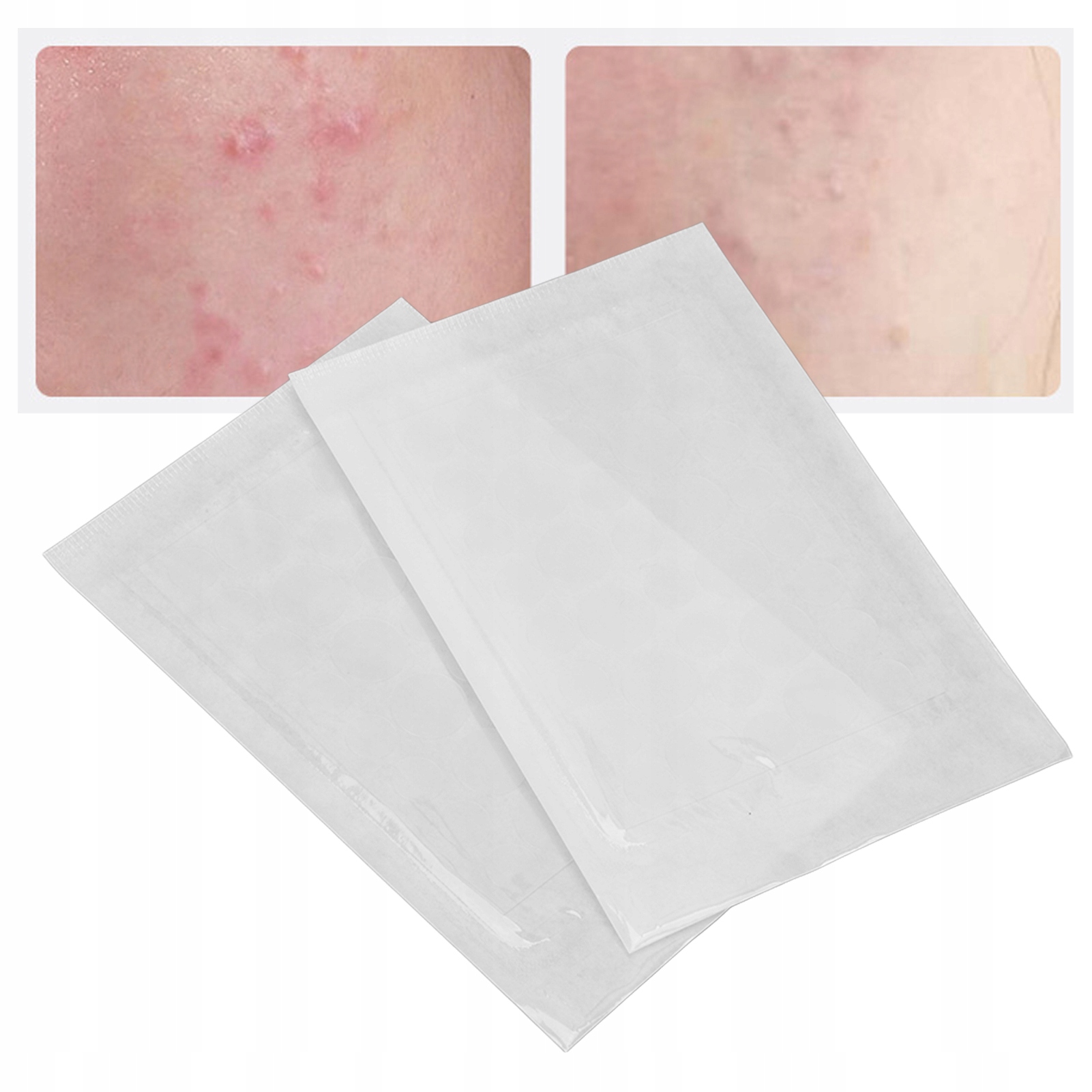 72X ACNE PATCHS NIGHT PLASTRY PRYSZCZE WYPRYSKI