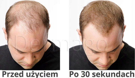 Mikrowłókna w Sprayu 200ml - BODEO - zagęszczanie* Marka Bodeo