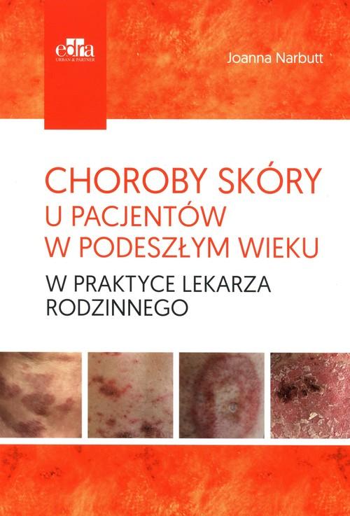 Choroby Skóry U Pacjentów W Podeszłym Wieku W...