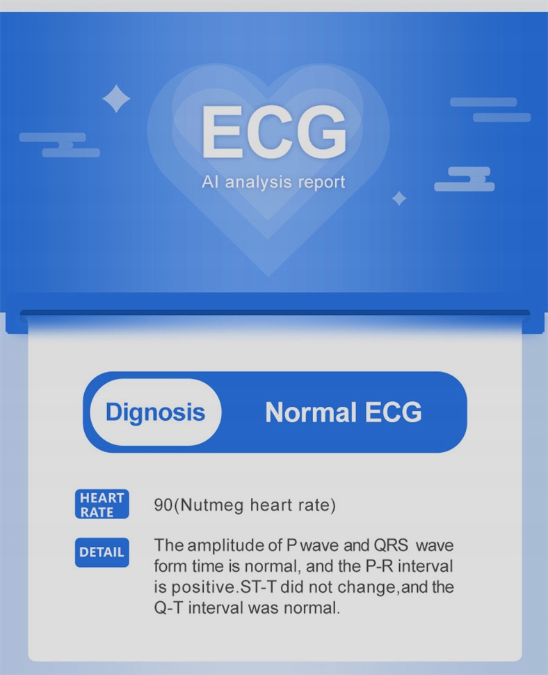 Smart Watch Heart Rate Blood Monitor Pressure Marka bez marki