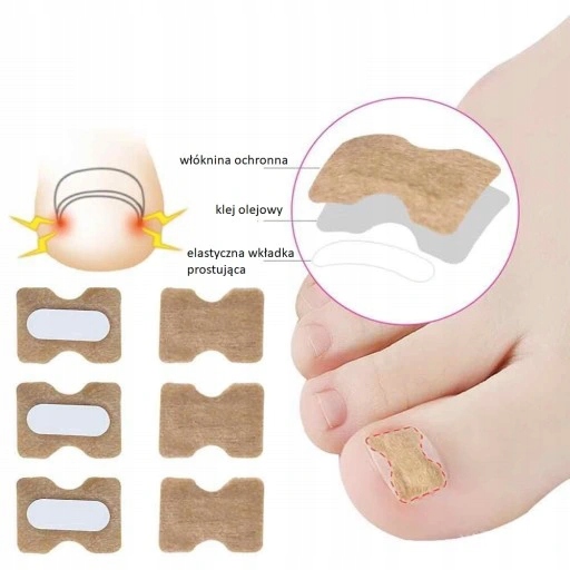 50x Paski plastry łatki na wrastające paznokcie Kod producenta NAU188R