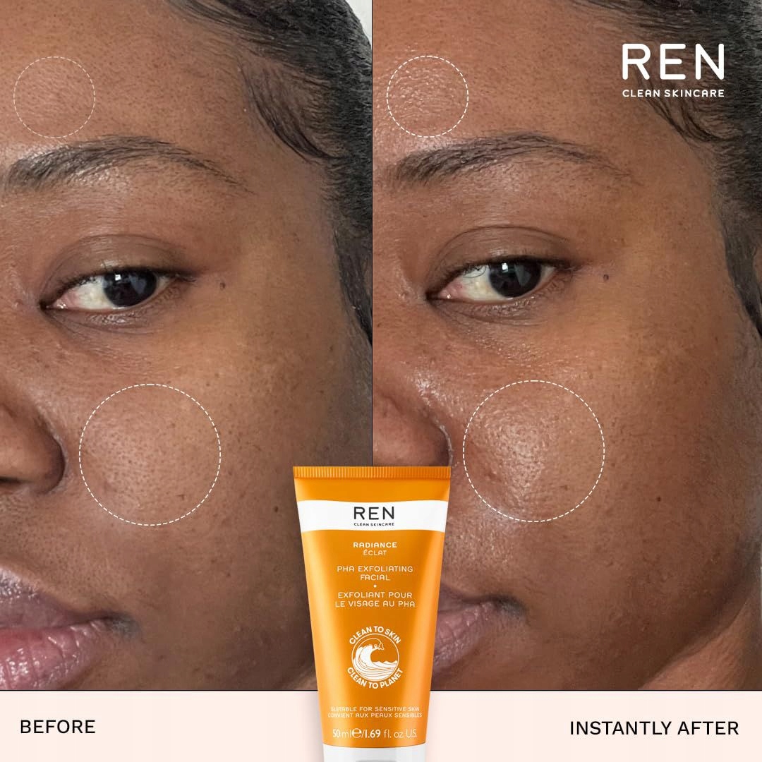 Ren Radiance Pha Exfoliační Pleťový Peeling 50 ML