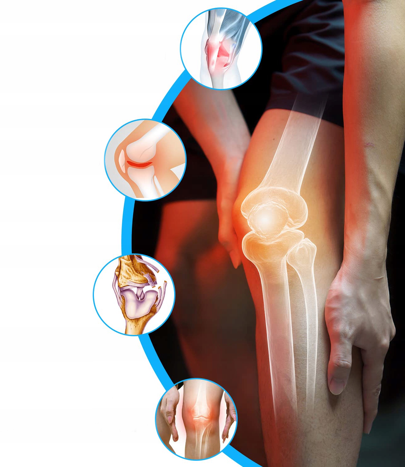 OPASKA UCISKOWA ORTEZA NA KOLANO ściągacz OCHRANIACZ KOLANA STABILIZATOR Rozmiar M