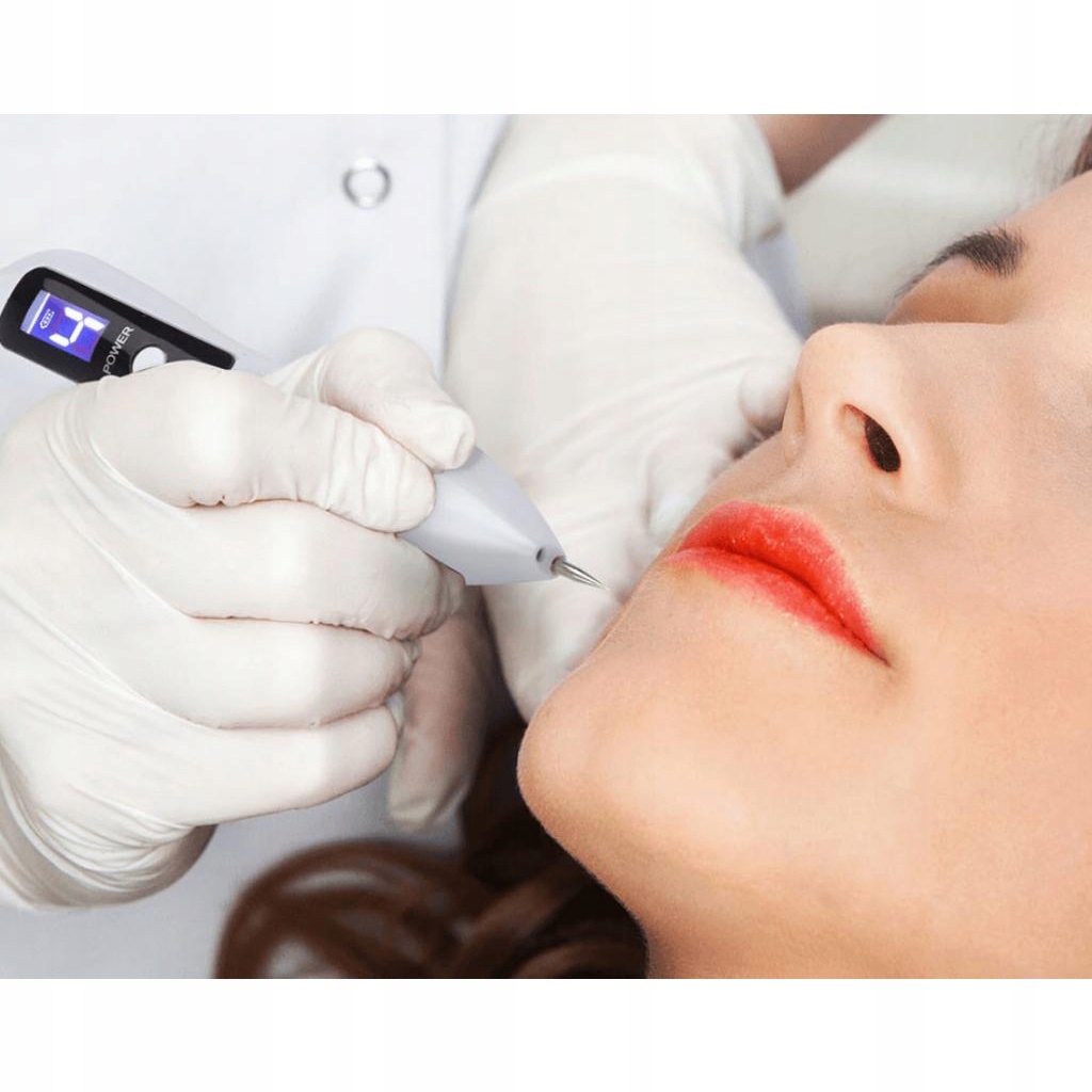 Plazmapen Laserowe Usuwanie Brodawek Blizn Tatuaży Rodzaj laser IPL