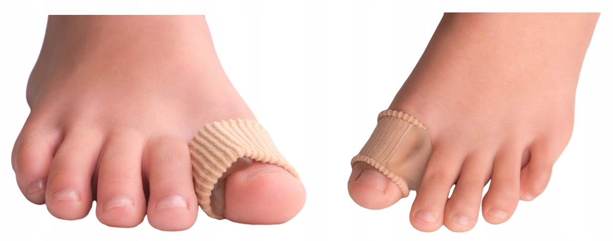 KLIN NA HALUKSY SEPARATOR ŻELOWY Z OPASKĄ MOCUJĄCĄ Model Vaya SmartGel