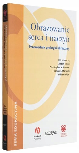 Obrazowanie Serca I Naczyń