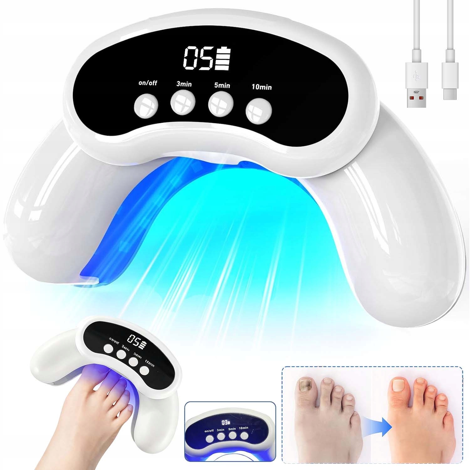 Laserové Zařízení Pro Léčbu Mykózy, Nehtů, Rukou A Nohou, 30 Led