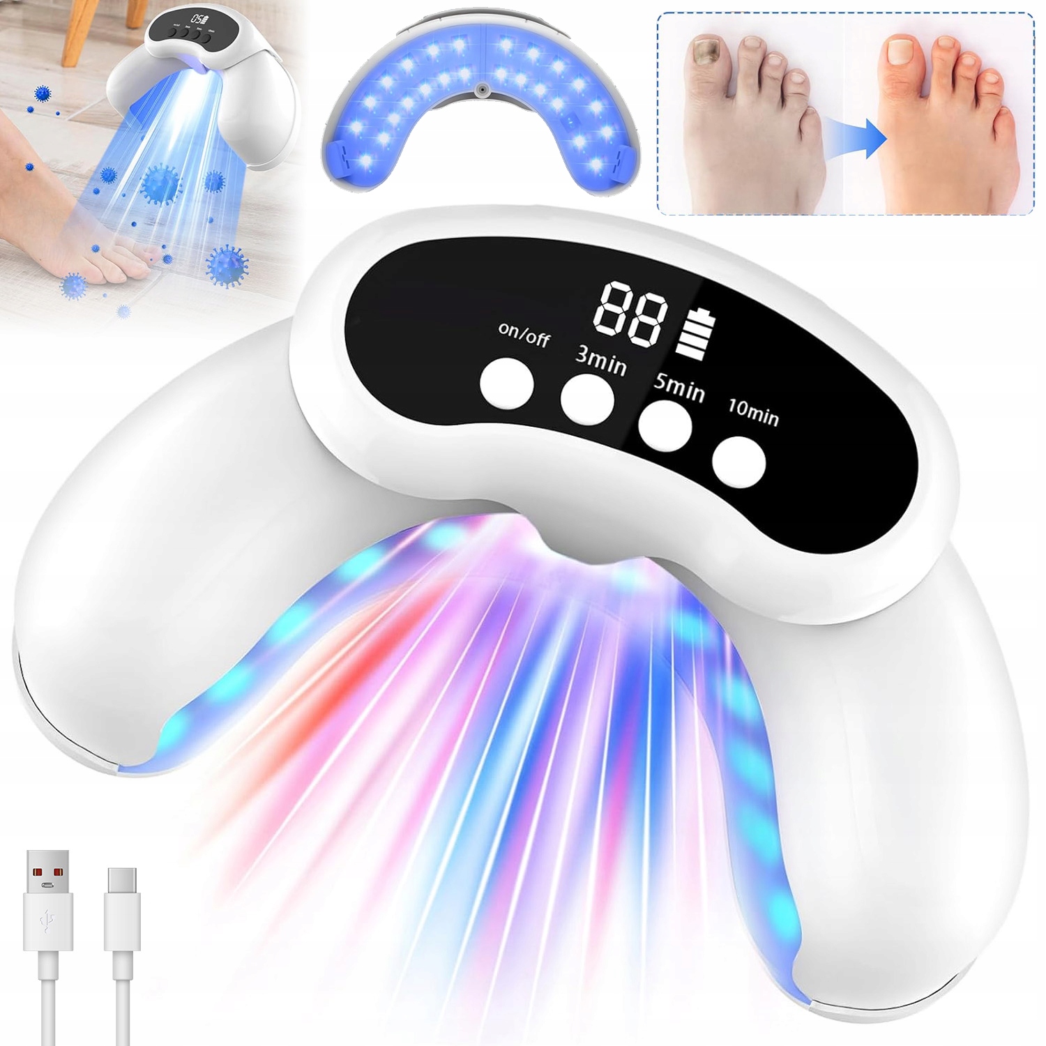 Protiplísňové Laserové Zařízení Pro Léčbu Mykózy Nehtů Na Nohou