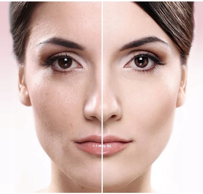 AMAZEFAN 7W1 MASAŻER LED MEZOTERAPIA EMS RF GRATIS Stan opakowania oryginalne