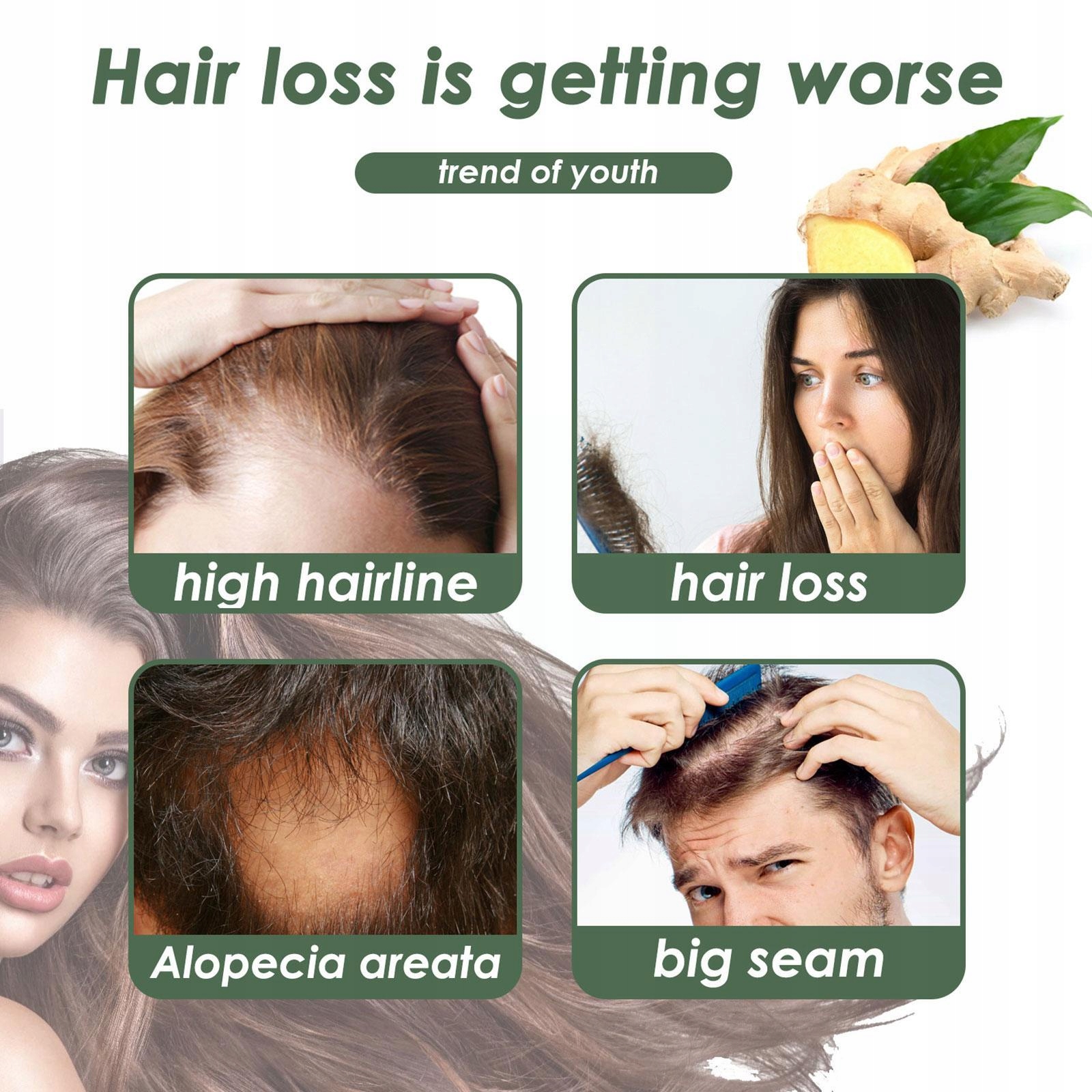 Anti-utrata Włosów Szampon Imbirowy Promowanie Marka Oneofthose