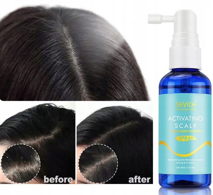 Activating Scalp Spray Redukcja Sebum Łupież Marka Sevich