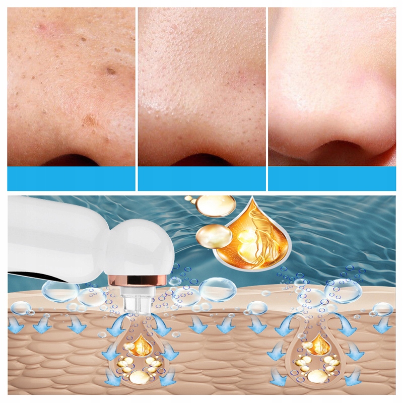 ODKURZACZ NA WĄGRY PRYSZCZY HYDRABRAZJA WODNA 6W1 Napięcie 3.7 V