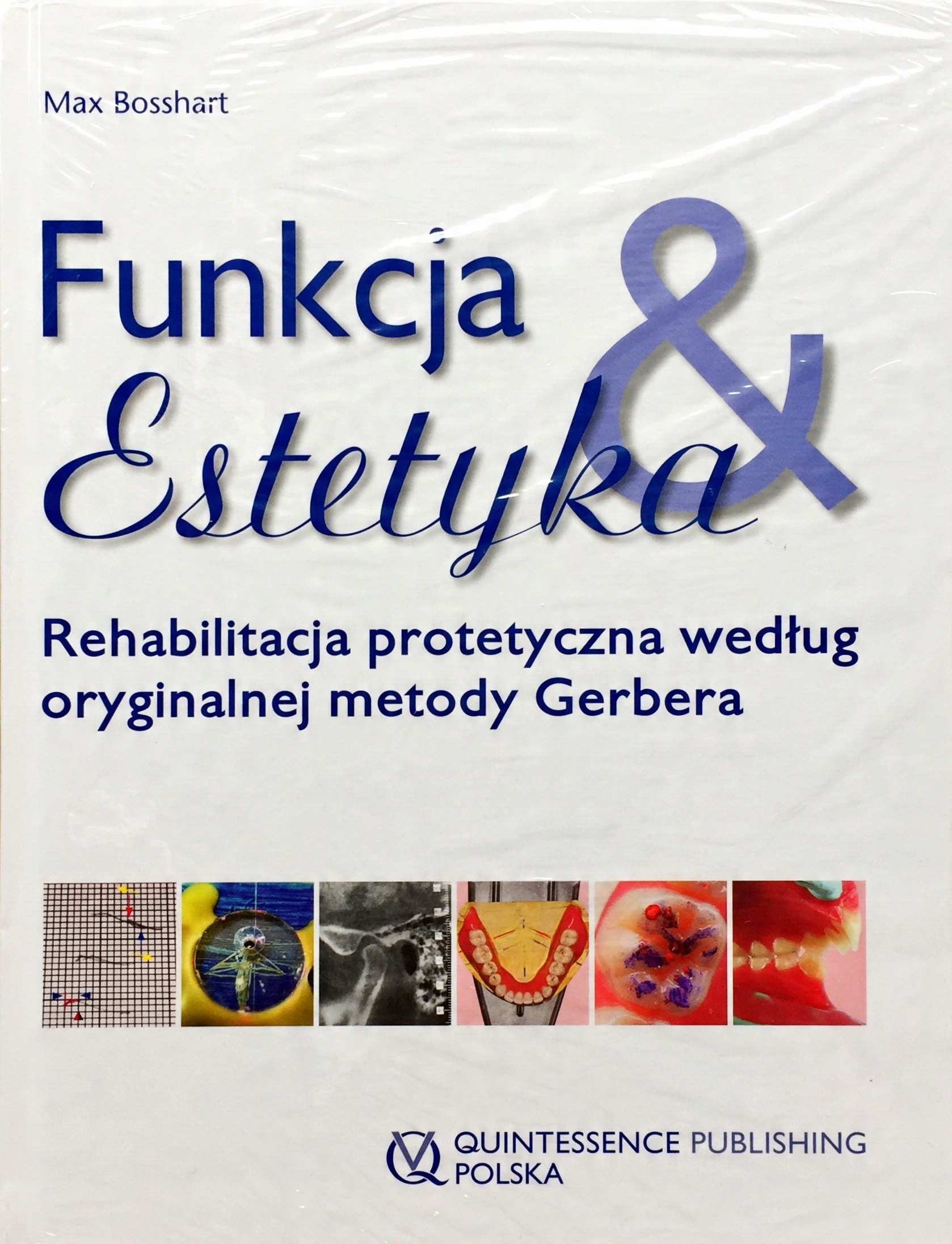 

Funkcja I Estetyka Rehabilitacja Protetyczna Wedłu