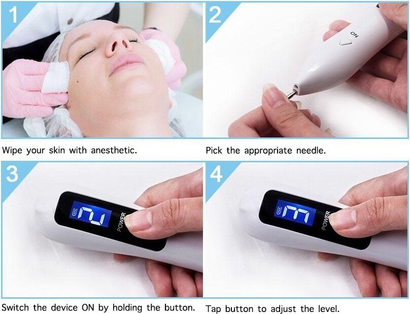 PLAZMAPEN LASEROWE USUWANIE BRODAWEK BLIZN TATUAŻY Długość urządzenia 18 cm