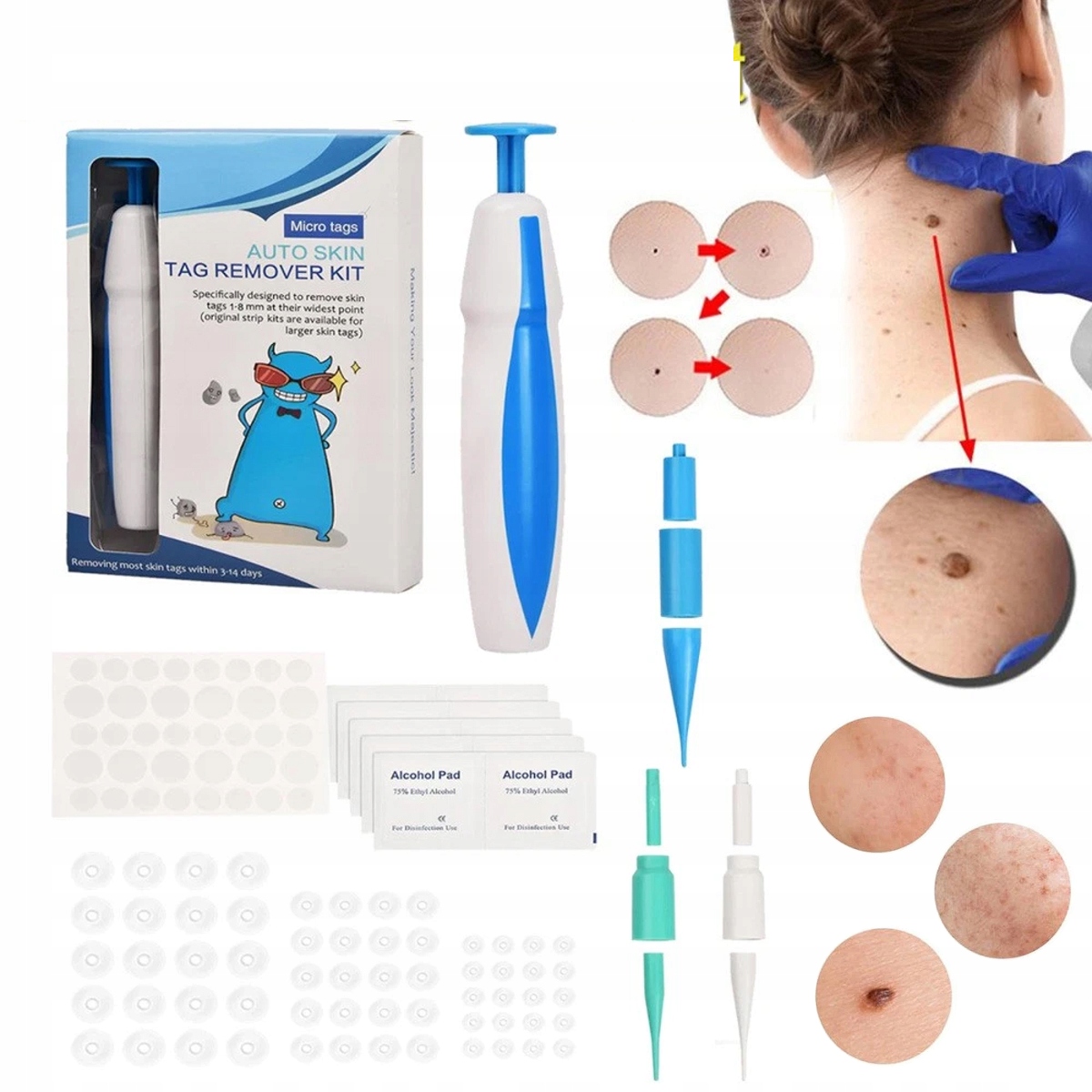 2 v 1 Sada na odstraňování kožních bradavic jako Dárek