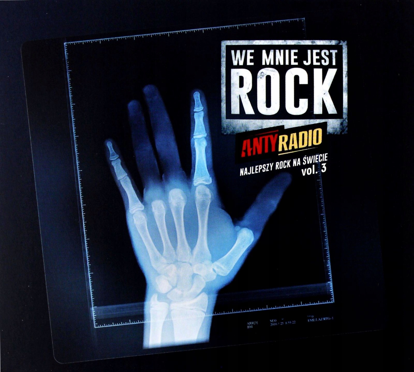

Antyradio Bo We Mnie Jest Rock (2CD)
