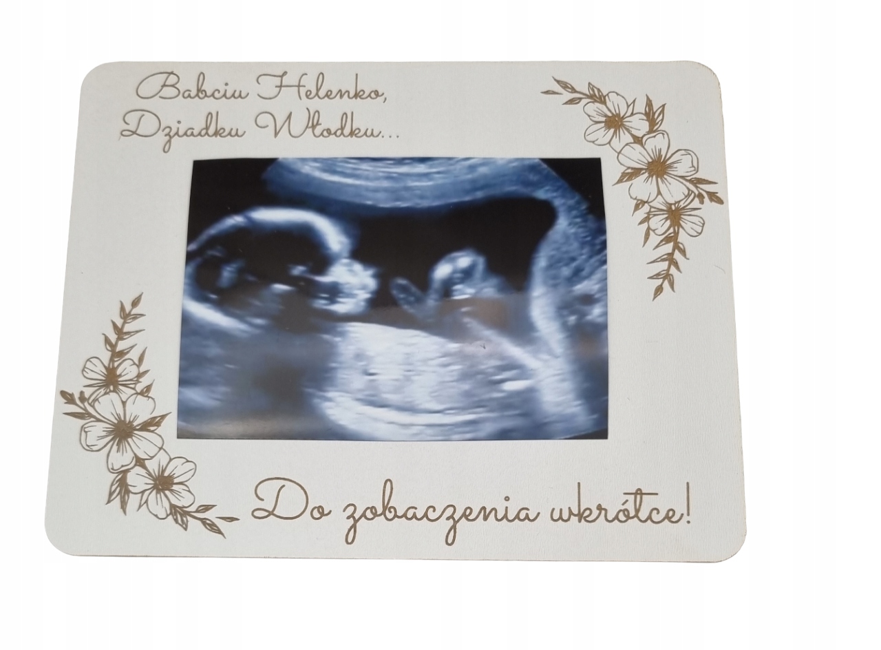 

Tabliczka zdjęcie Usg zostaniecie dziadkami