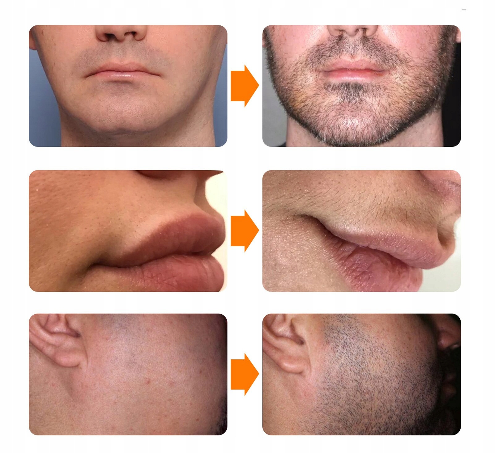 ROLER DO BRODY ZAROST WŁOSÓW DERMA ROLER WAŁEK Model brak