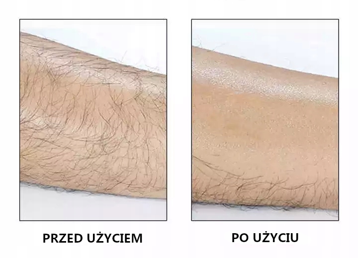 BEZBOLESNY DEPILATOR WŁOSÓW DEPILACJA RÓŻNE KOLORY Szerokość produktu 7 cm