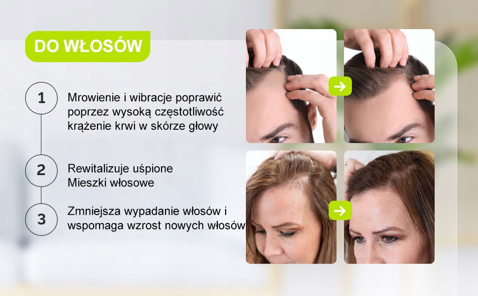 GESS WAND DARSONVAL NAJMOCNIEJSZY 10 W 4 ELEKTRODY TWARZ CIAŁO WŁOSY Stan opakowania oryginalne