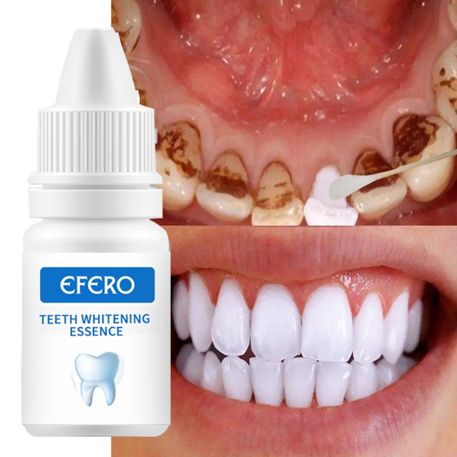 Bột tinh chất làm trắng răng EFERO Clean Oral