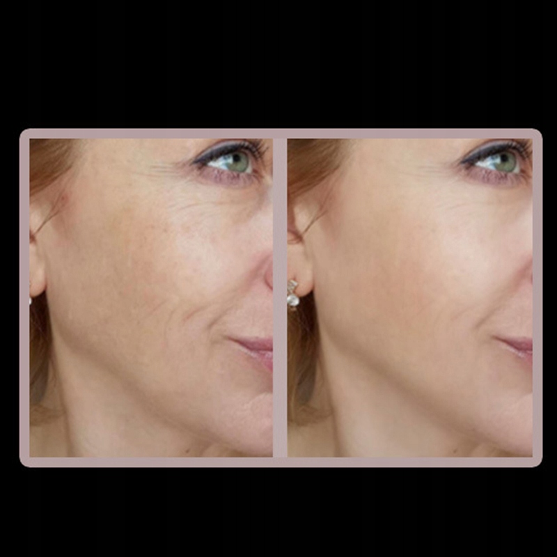 MASAŻER TWARZY LIFTING V PODBRÓDKA TERAPIA LED 2W1 Marka bez marki