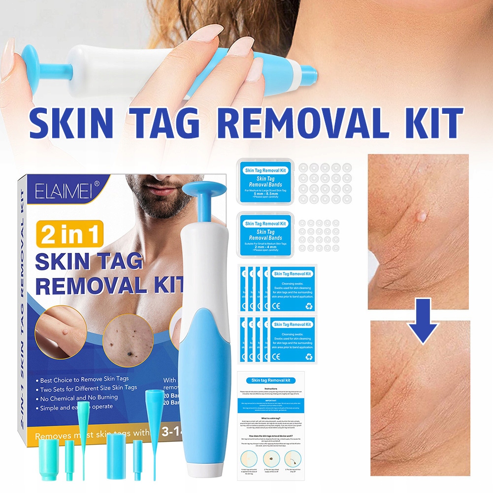 2 IN 1 Auto Skin Tag Remover Kit Micro Skin Tag Kod producenta 56656658