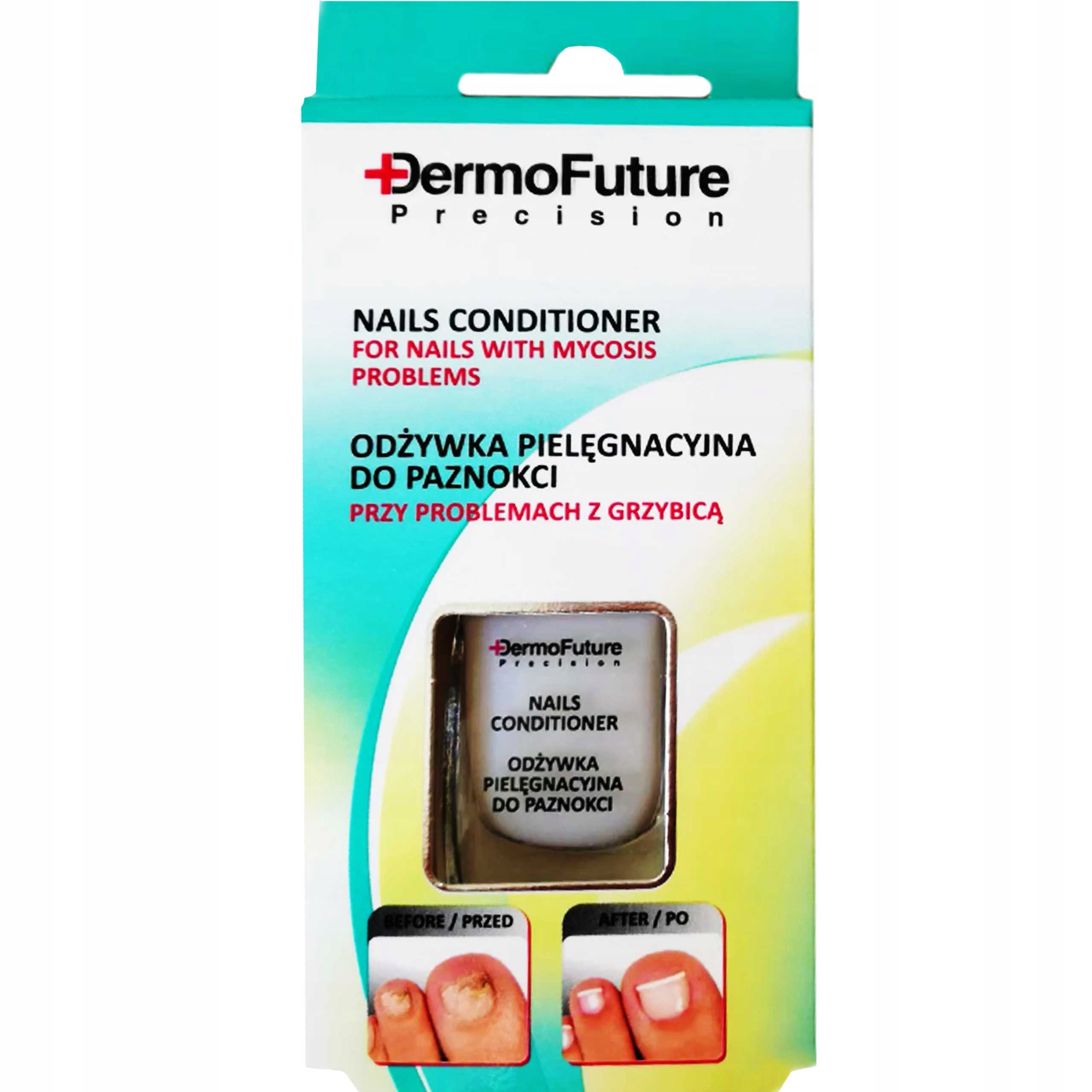 

Dermofuture Terapia przeciw grzybicy paznokci
