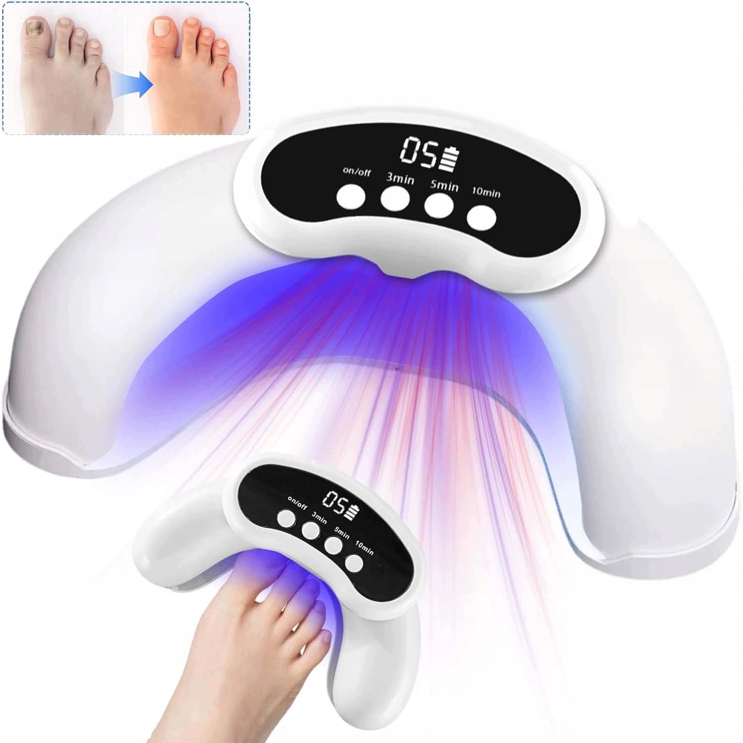 Uv Lampa Pro Léčbu Mykózy Nehtů Domácí Přenosná Malá 905 Nm 470 Nm
