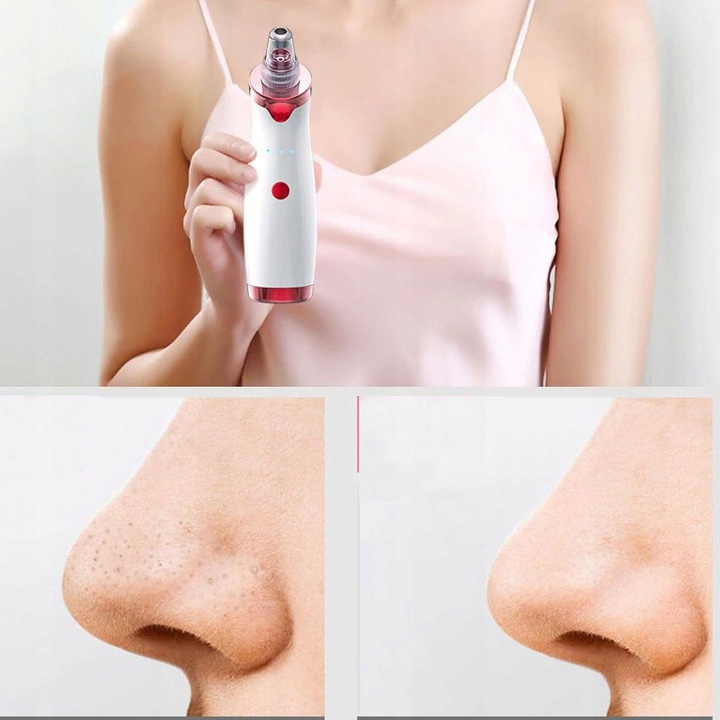 PEELING KAWITACYJNY ODKURZACZ WĄGRÓW ZESTAW XXL Moc 3 W