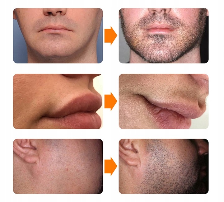 Zestaw na porost brody Serum 30ml oraz Roller Marka bez marki