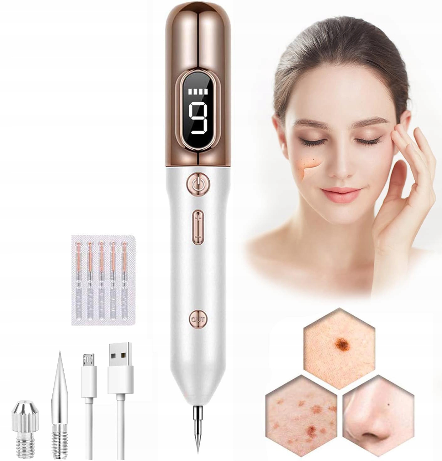 Bezbolestný plazmový laser odstraňuje bradavice bez poškození pokožky Bezpečný