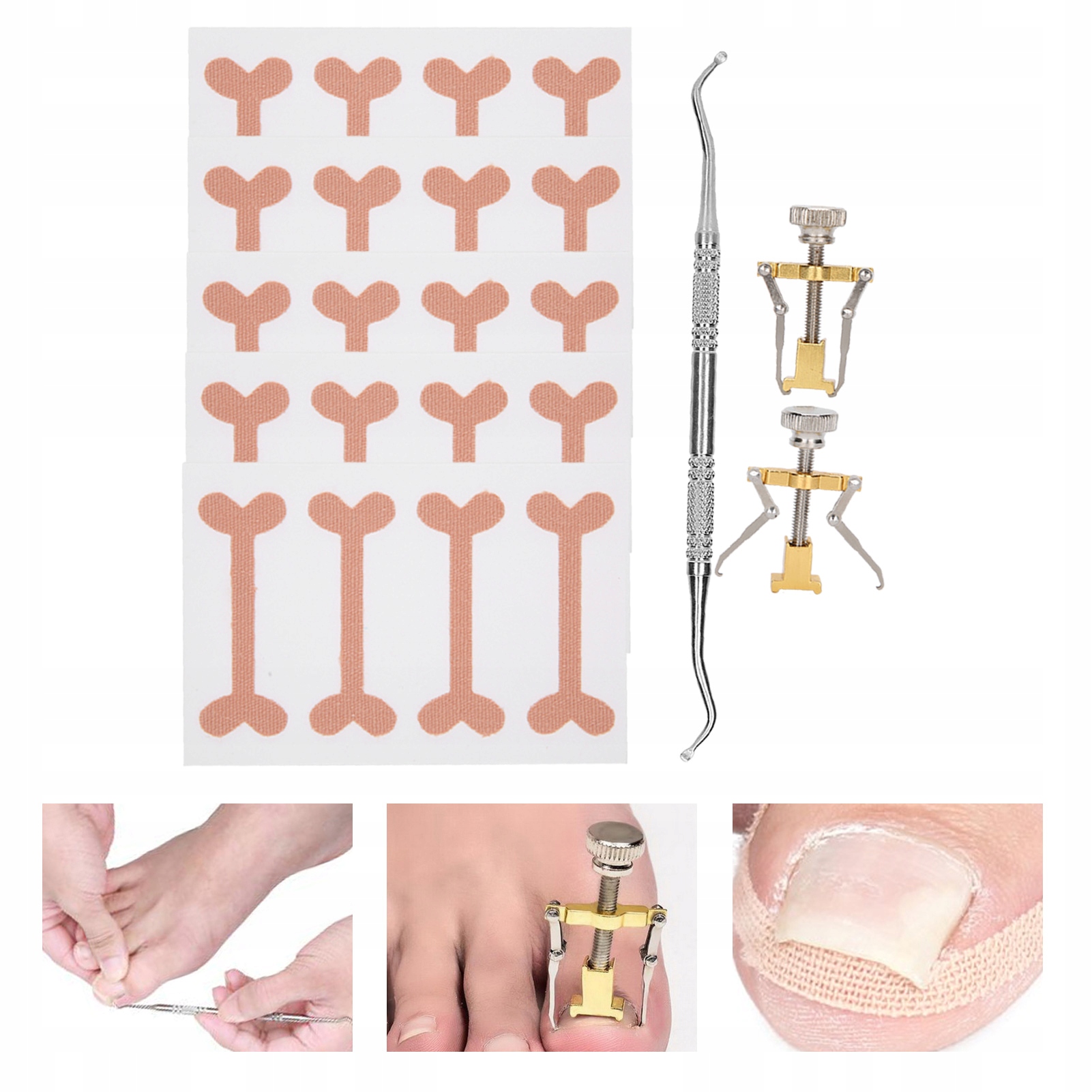 ZESTAW KOREKCYJNY KLAMRA NA WRASTAJĄCA TAŚMA KOREKCYJNA DO PAZNOKCI U STÓP EAN (GTIN) 6944848395093