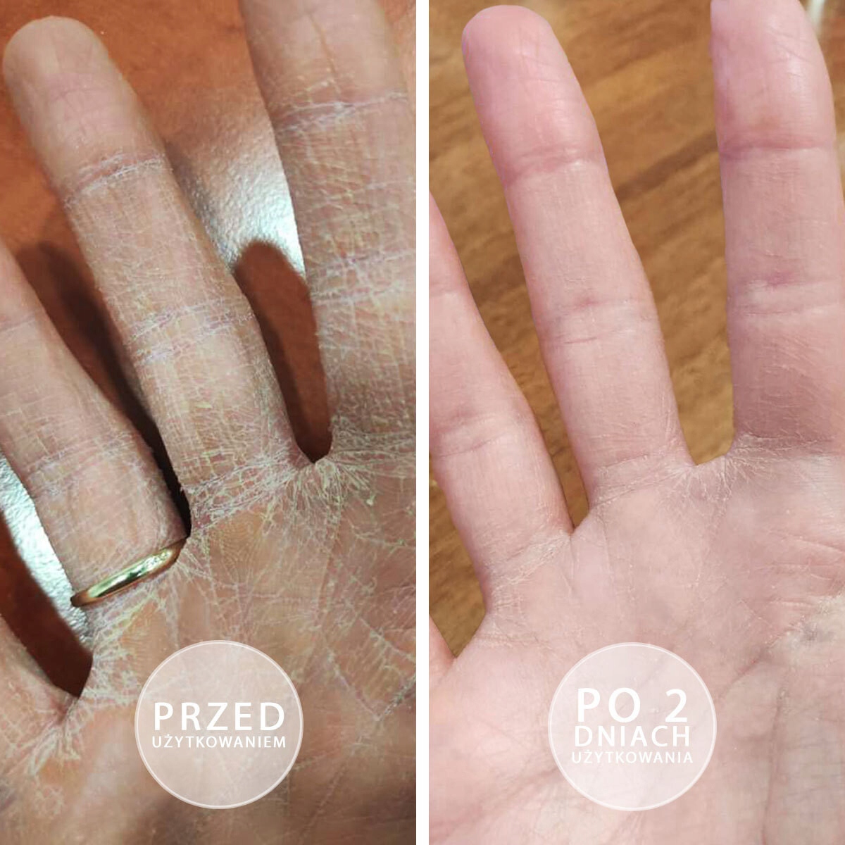 Maść z witaminą E do rąk, do skóry suchej BEAUTICA natłuszczająca SOS 100ml Wielkość Produkt pełnowymiarowy