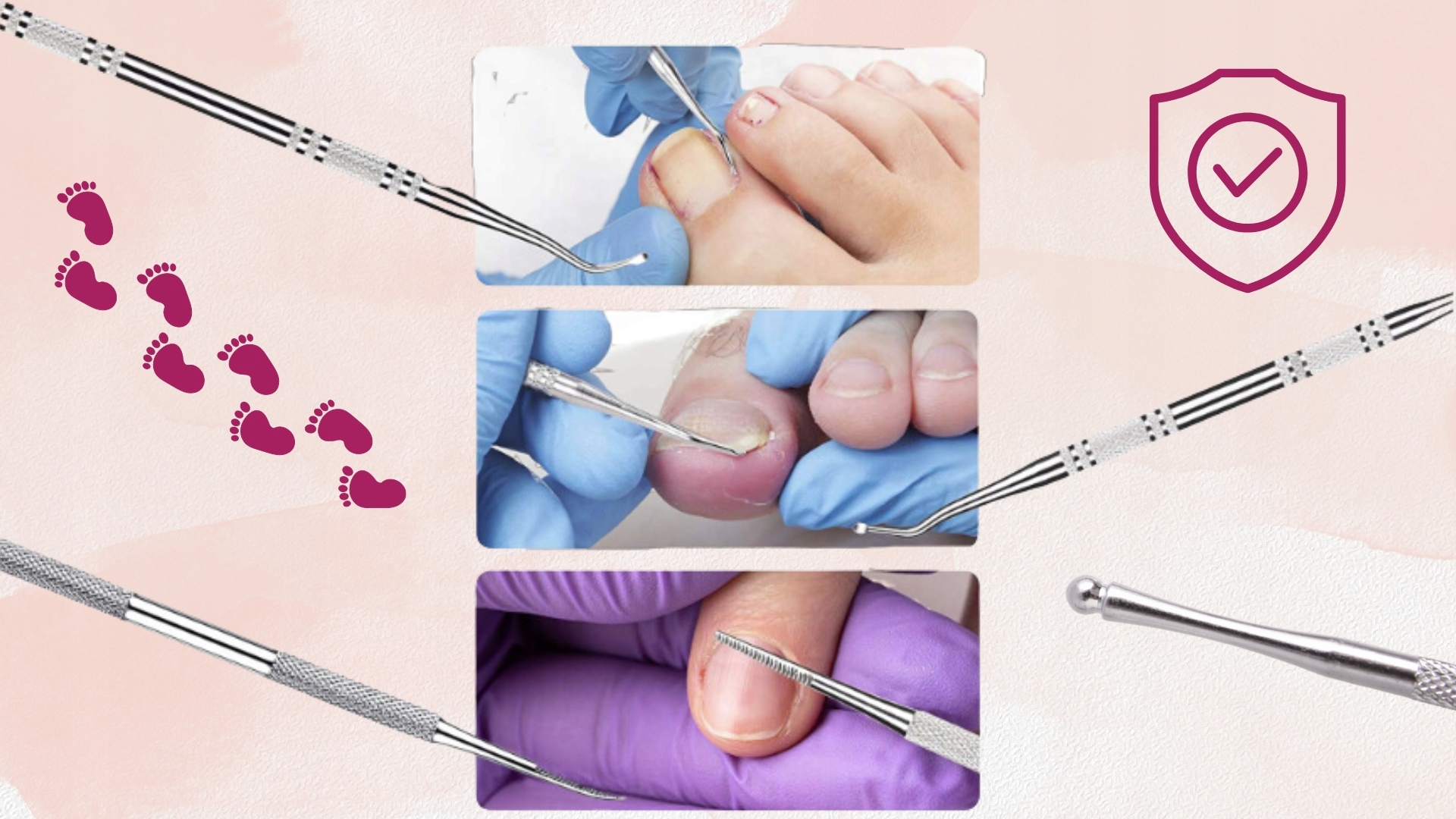 ZESTAW DO WRASTAJĄCYCH PAZNOKCI ŁYŻECZKI PODOLOG Stan opakowania oryginalne