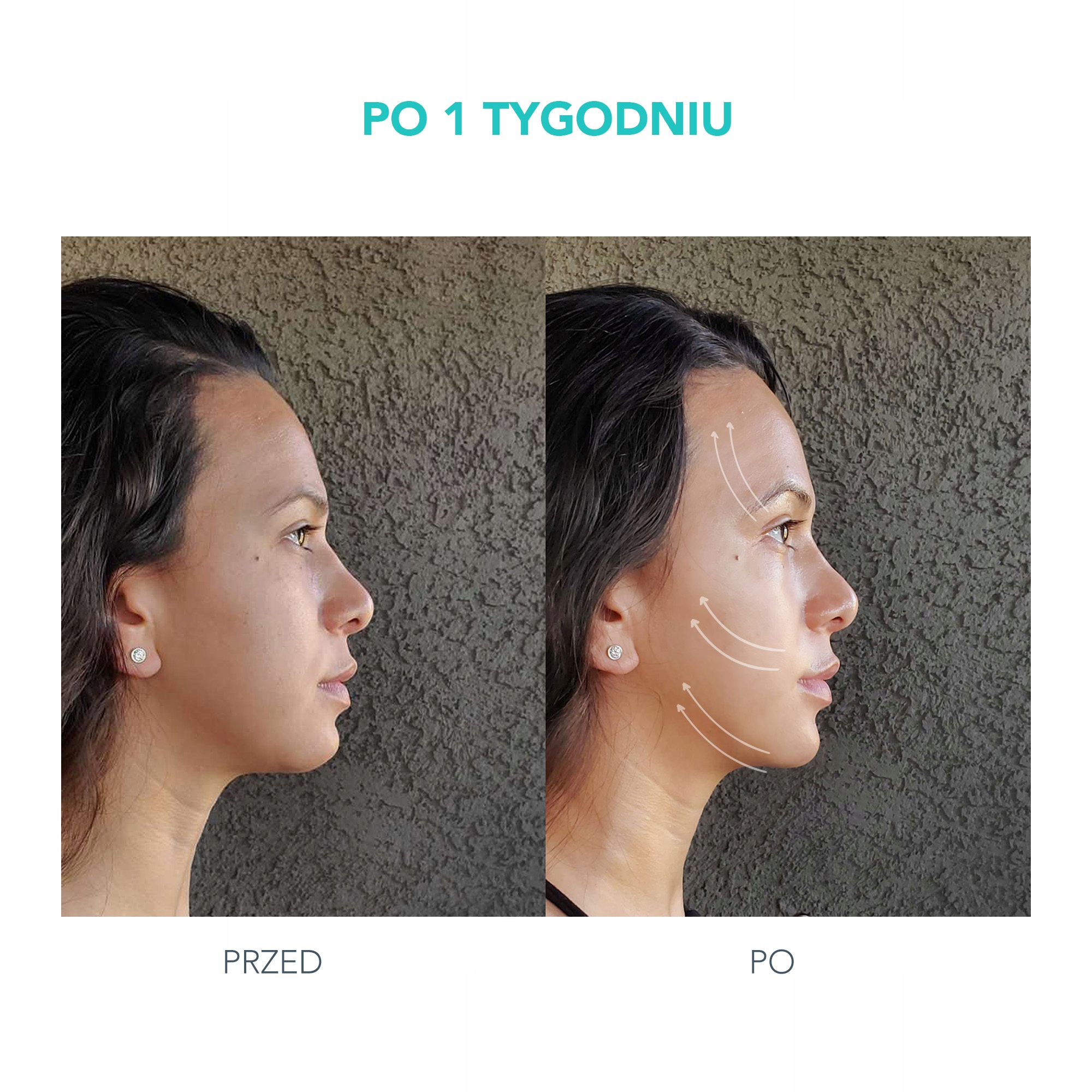 FOREO BEAR Mint Urządzenie do modelowania twarzy Rodzaj soniczna