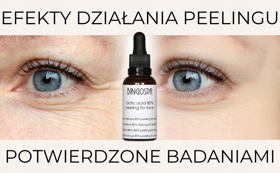 MOCNY PEELING KWASOWY DO TWARZY 30 ml BINGOSPA Rodzaj kwas