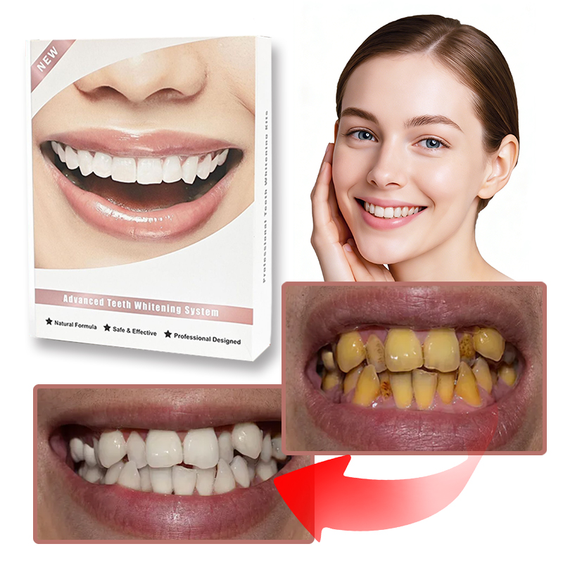 Żel Do Wybielania Zębów 5 żeli lampka Led nakładka na zęby Pełny zestaw