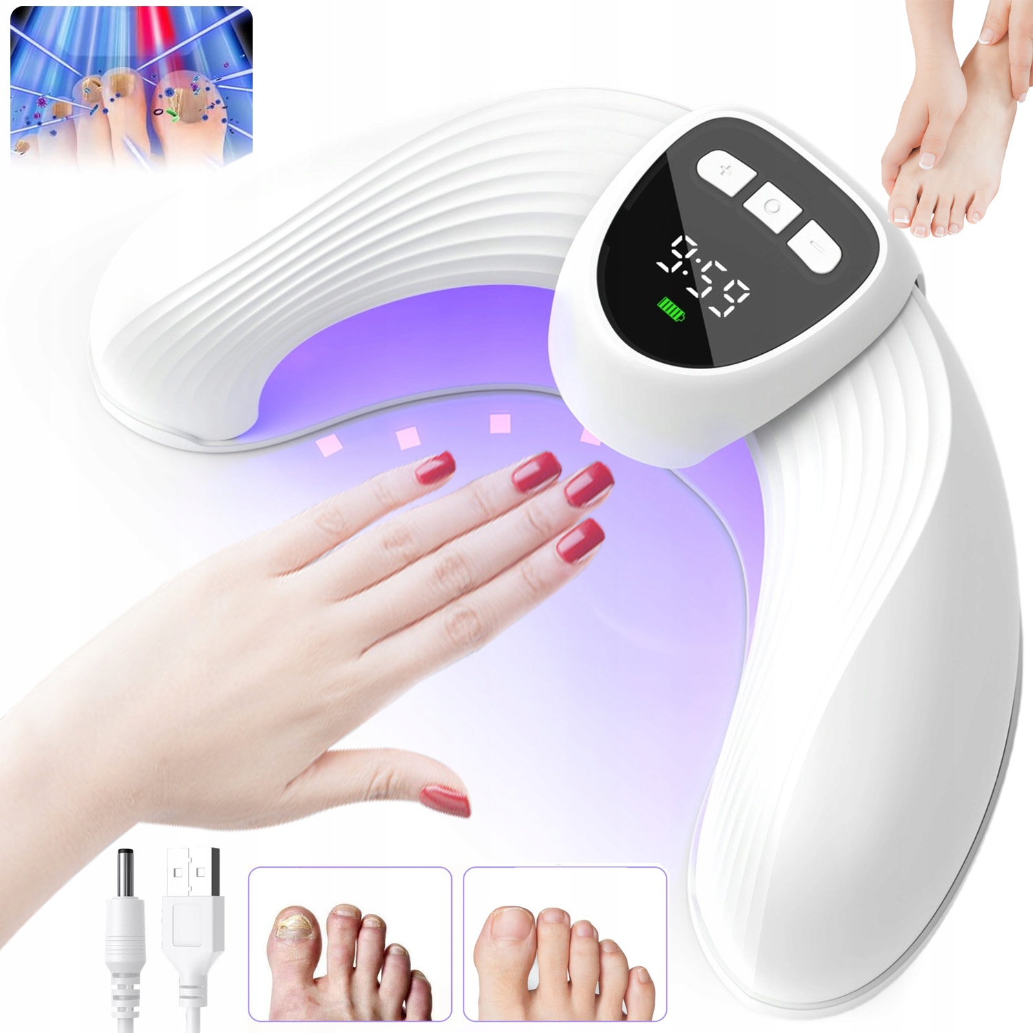 Protiplísňové Laserové Zařízení Pro Léčbu Mykózy Nehtů Na Nohou 45 W