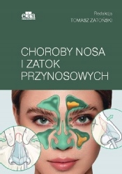 

Choroby nosa i zatok przynosowych