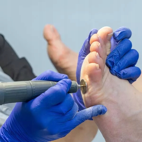 Staleks nakładki ścierne do PODODISC M PDF-20-80W Marka Staleks