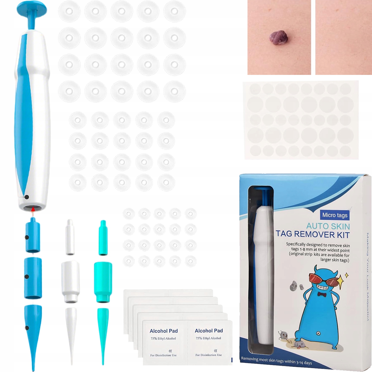 2 V 1 Sada nástrojů pro automatické odstraňování kožních výrůstků Zařízení